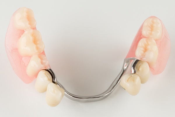 Partial dentures